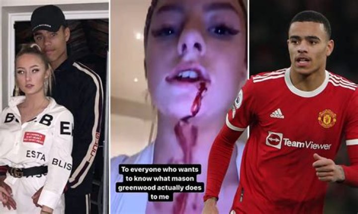 Harriet Robson Shared Photos & Videos Of Her Boyfriend Trying To Rape Her